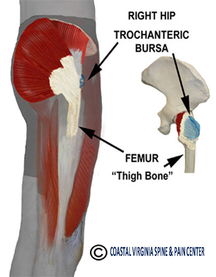 Trochanteric Bursa Coastal Virginia Spine Pain Center