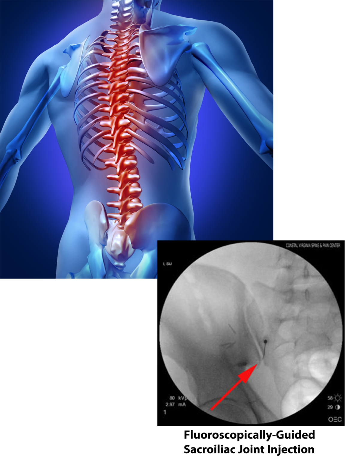 Coastal Virginia Spine And Pain Home Coastal Virginia Spine Pain Center